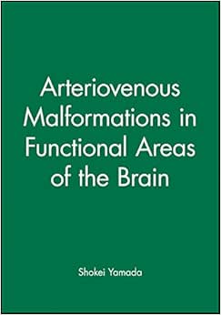 《arteriovenous malformations in functional areas of the brain》
