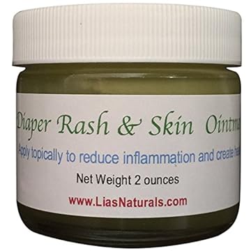 【美国亚马逊】 diaper rash, cradle cap skin ointment & eczema